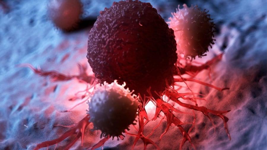 10 dấu hiệu cảnh báo ᴜng thư sớm ở trẻ εm: Bṓ mẹ cần biḗt sớm ᵭể cứu mạng con