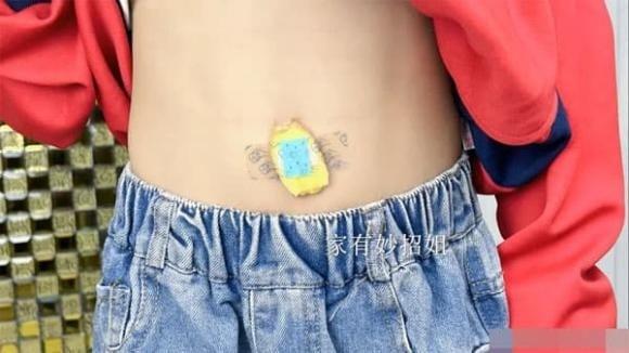 Vào mùa hè, muỗi thường xuyên gây phiền toái với những vết đốt khó chịu, gây ngứa ngáy kéo dài. 