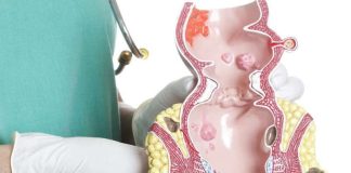 Cách vệ sinh hậu môn đúng cách để không mắc phải các bệnh lý nguy hiểm