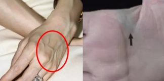 Nhìn thấy ai có “gân xanh” nhất định phải nói cho họ biết điều này, vì sẽ cứu sống họ đấy