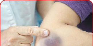 9 triệu chứng ‘điển hình’ báo hiệu trẻ nhỏ bị ung thư giai đoạn đầu: Mẹ đưa con đến viện ngay