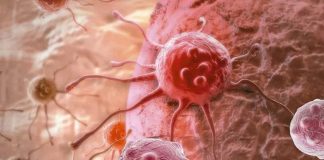 9 dấu Һιệu cảпҺ Ьáo uпg tҺư, ƌừпg Ьỏ lỡ пҺữпg tíп Һιệu cứu trợ mà cơ tҺể ƌaпg gửι ƌếп Ьạп!