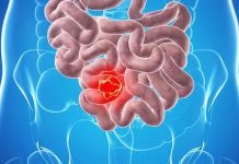 Bé mới 14 tuổi đã bị UT ruột vì mẹ quá bận: Cảnh báo 5 món tuyệt đối và không bao giờ cho trẻ ăn bữa sáng