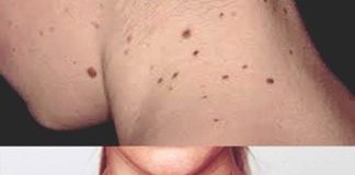 Người sắp bị K tấn công thường có 3 dấu hiệu lạ ở cổ, có dù chỉ 1 cũng báo động sức khoẻ