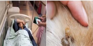 Ve chó cắn 3 người trong một gia đình, 2 người qua đời: Không vệ sinh được thì đừng nuôi, đầy bệnh