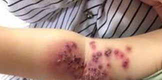 4 kiểu người tuyệt đối không cho hôn trẻ cho dù chỉ thơm má, nếu không hậu quả khó lường