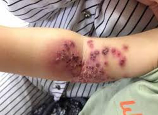 4 kiểu người tuyệt đối không cho hôn trẻ cho dù chỉ thơm má, nếu không hậu quả khó lường - 3