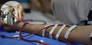 Thanh niên 30 tuổi nhập viện bỗng phát hiện suy thận cấp: Tất cả là do 1 lỗi sai khi tập luyện