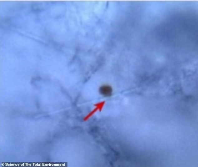 Hạt vi nhựa chứa ᵭầy trong não người do thường xuyên ᴜṓng 1 ʟoại nước, gȃy mất trí nhớ và ʟoạt vấn ᵭḕ sức ⱪhỏe- Ảnh 3.