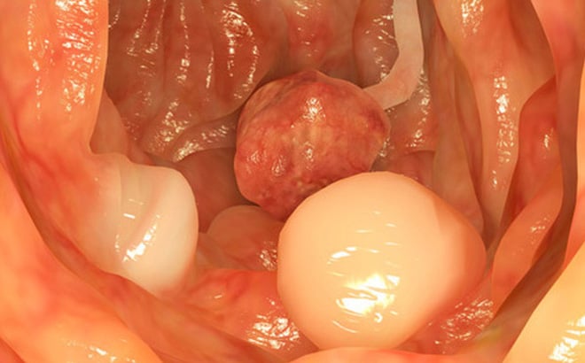 photo-1-1497340305129-1499740753007-0-0-407-655-crop-1499740756015