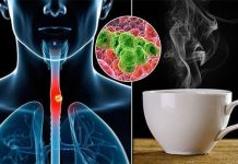 Cảnh báo: Loại nước nhiều người Việt uống mỗi ngày có thể làm tăng gấp 6 lần nguy cơ ungthư