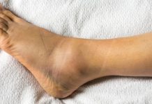 Hai bàn chân xuất hiện 5 dấu hiệu lạ, coi chừng gan đang ‘kêu cứu’: Hãy đi khám ngay đừng chủ quan