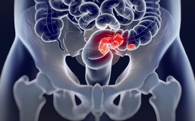 photo1536020216715-15360202167161667079905