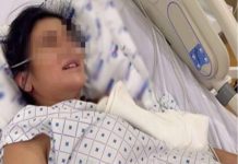 Mắc ungthư ở tuổi 24, cô gái kêu gọi người trẻ: Nếu thấy 3 dấu hiệu này, đừng bao giờ bỏ qua