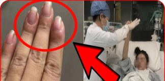 Ngón tay sưng to, cô gái điếng người khi biết bệnh K đã chuyển nặng