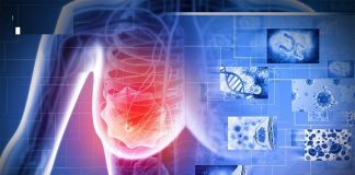 “3 đen” xuất hiện trên cơ thể báo hiệu bệnh K rất gần, gặp bác sĩ ngay