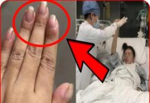 Ngón tay sưng to, cô gái điếng người khi biết bệnh K đã chuyển nặng