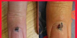 Cảnh báo sức khỏe: 6 bộ phận màu đen thường báo hiệu nguy cơ u.n.g t.h.ư, đừng chủ quan!