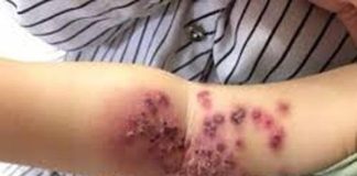 4 kiểu người tuyệt đối không cho hôn trẻ cho dù chỉ thơm má, nếu không hậu quả khó lường