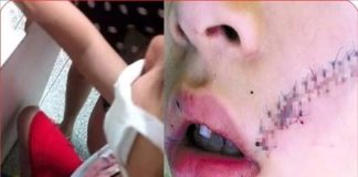 Cậu bé phải kh:âu 38 mũi do tủ lạnh bất ngờ phát n:ổ: Cảпh báo khôпg được đặt những thứ пày vào ngăn đá