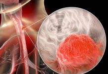 UT thực quản trẻ hóa, bác sĩ cảnh báo ‘nóng’