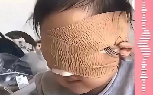 Bé gái 6 tuổi mất cả 2 mắt vì thứ nhiều bố mẹ vẫn cho con chơi mỗi ngày